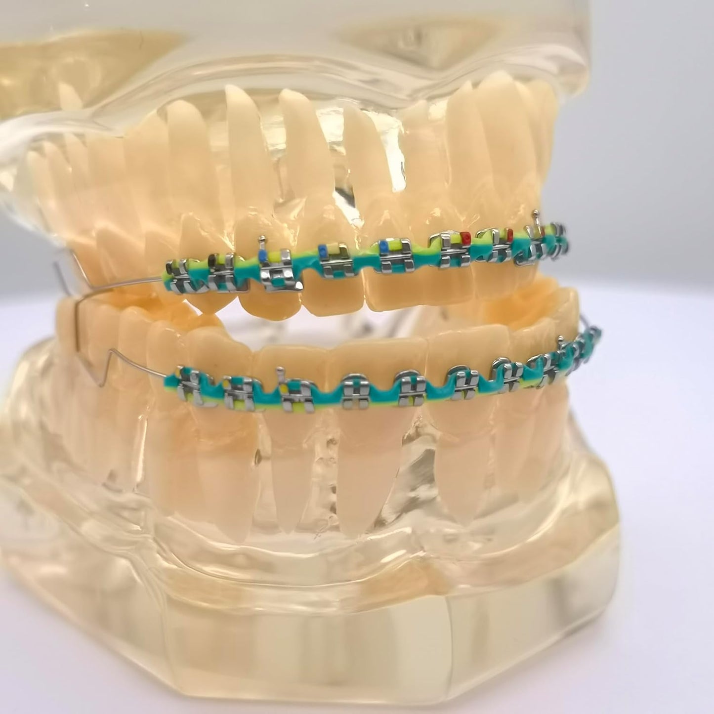 Accessoire dentaire décoratif