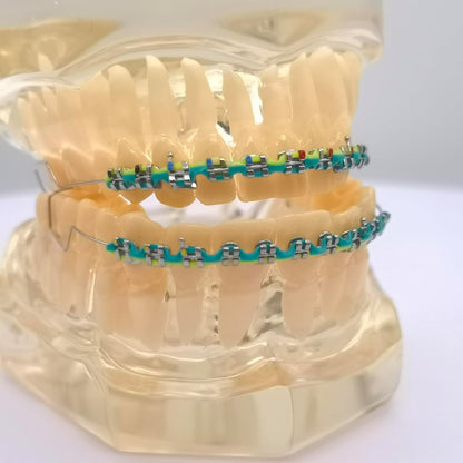 Accessoire dentaire décoratif