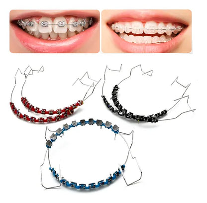 Accessoire dentaire décoratif