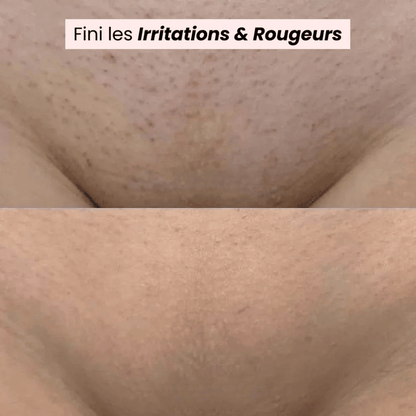 Tondeuse bikini et corps 2 en 1